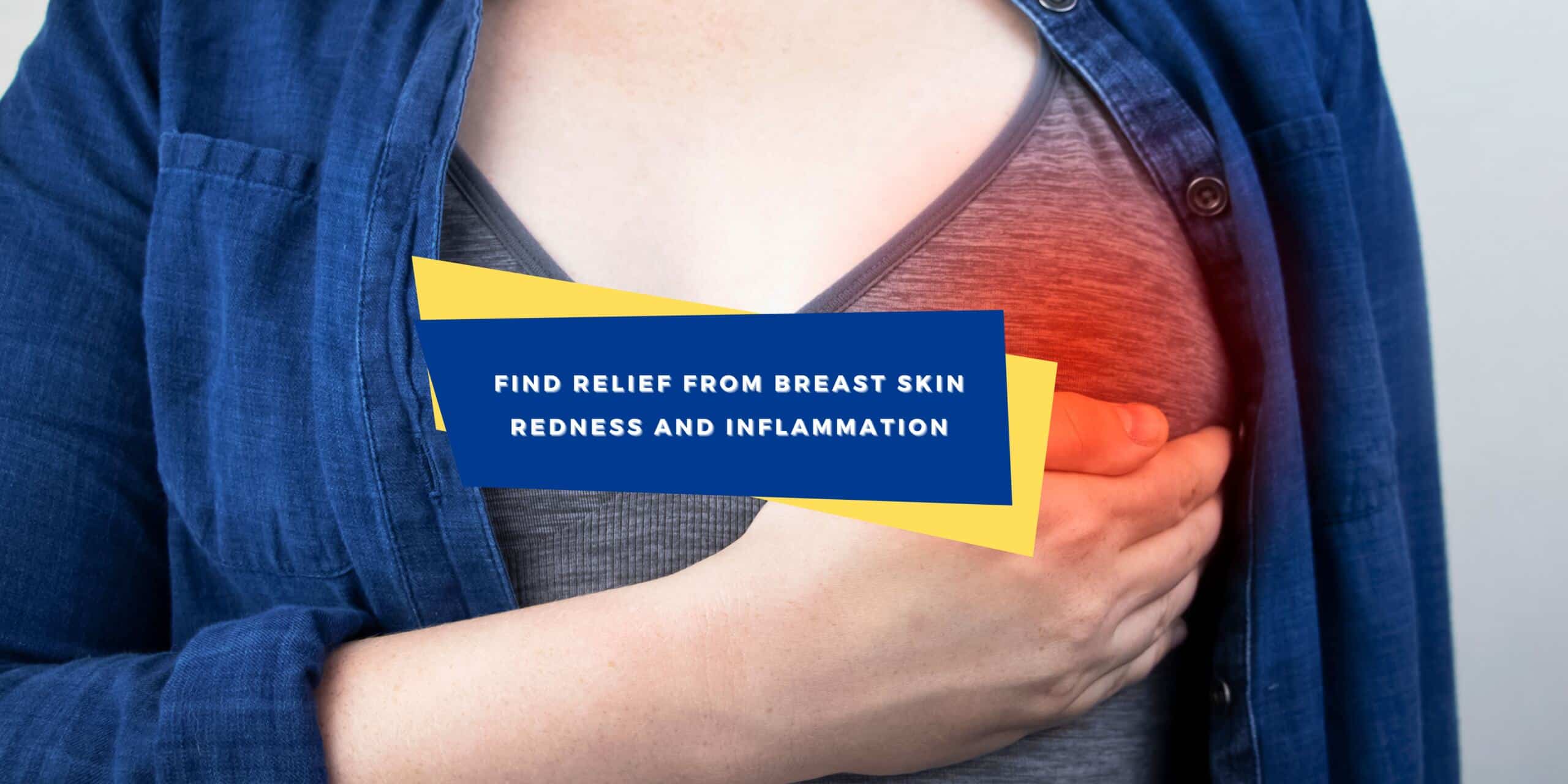 4-causes-of-redness-in-breast-skin-and-how-to-fix-them