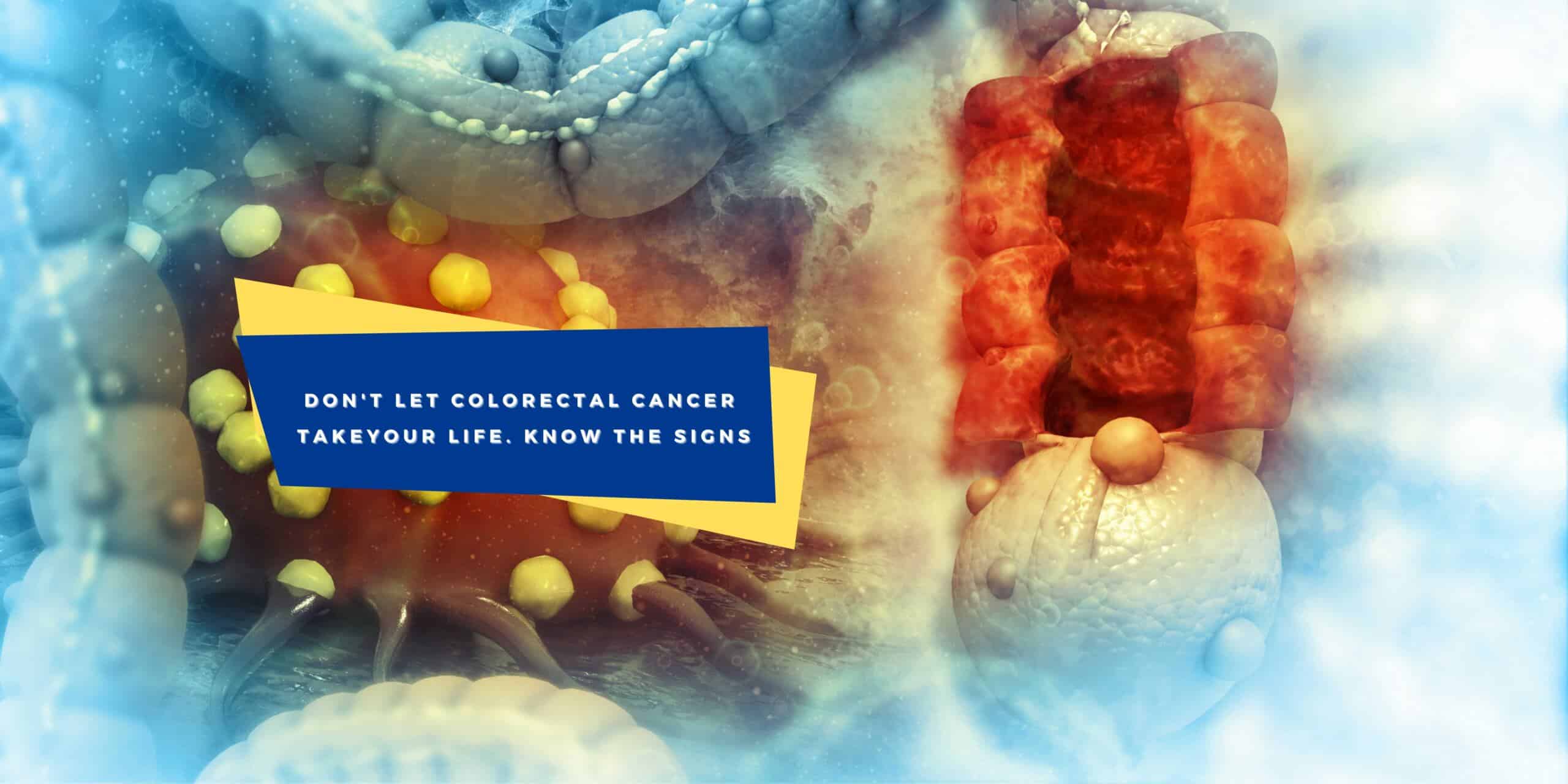 colorectal-cancer-what-you-need-to-know