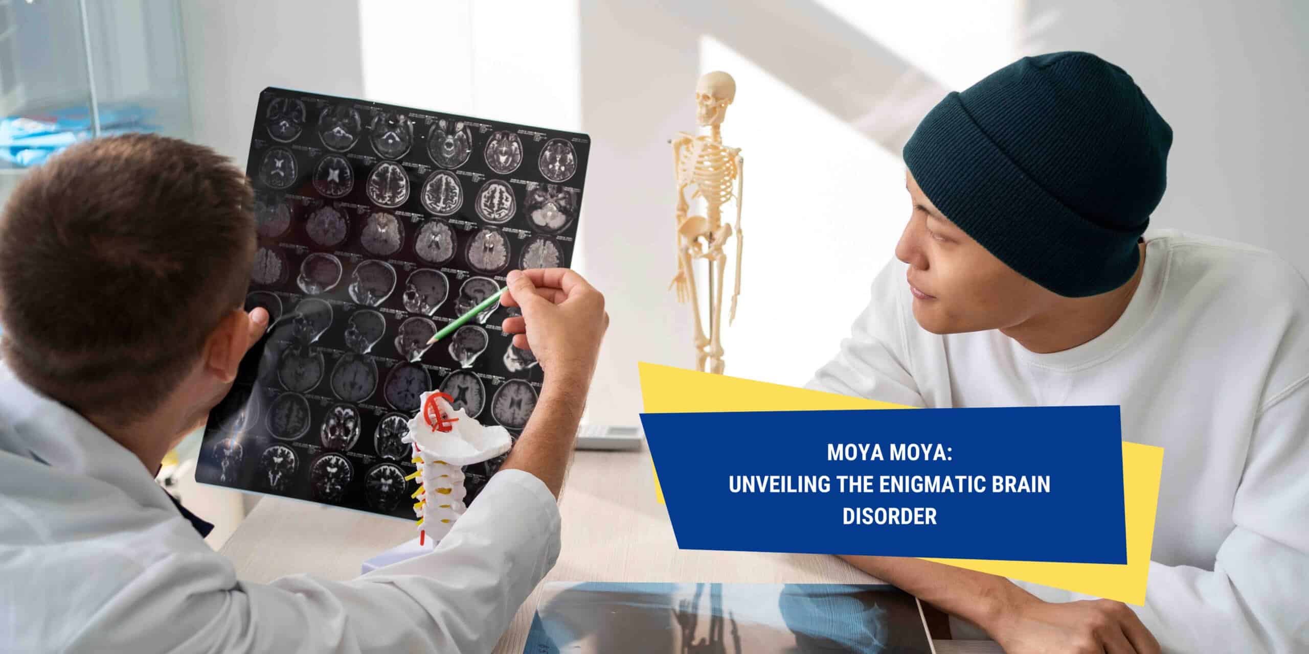 Moya Moya: Unveiling the Enigmatic Brain Disorder | OneHealth.sg 